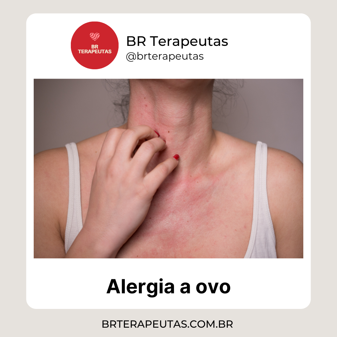 O que é a alergia a ovo