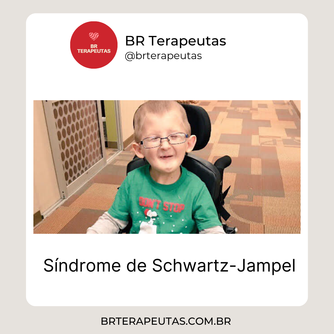Causas e sintomas da Síndrome de Schwartz-Jampel. Foto de uma criança
com numa cadeira de rodas