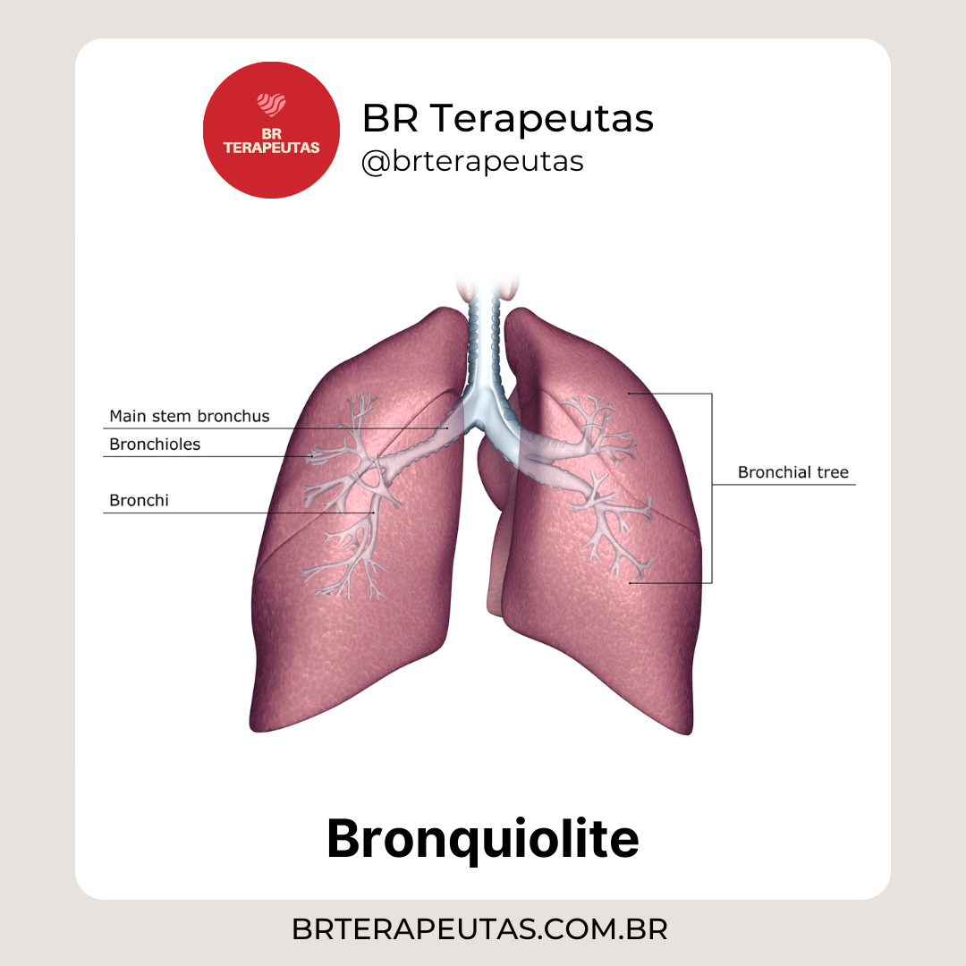 O que é a Bronquilite?