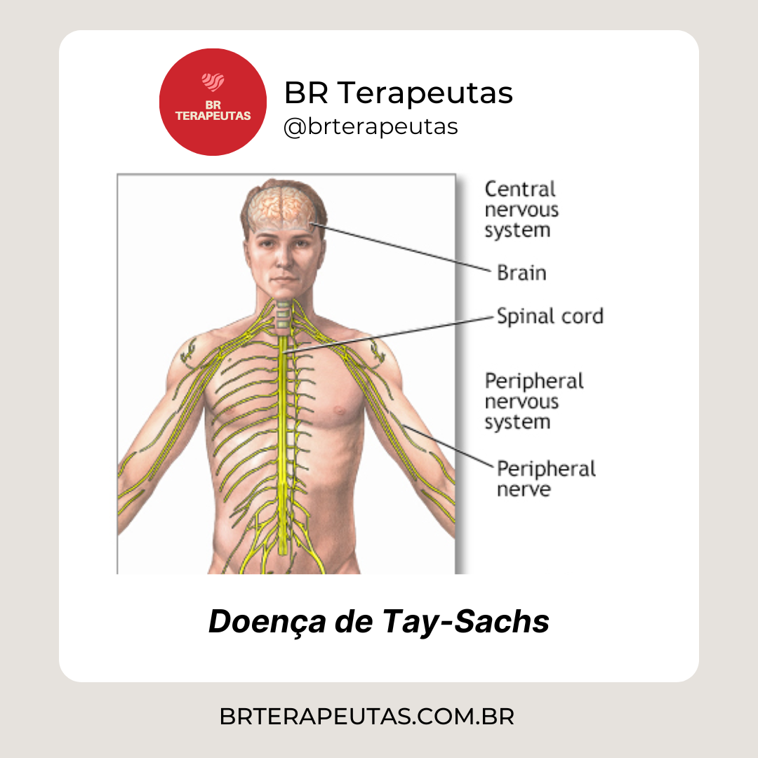 Foto das condições doença de Tay-Sachs
