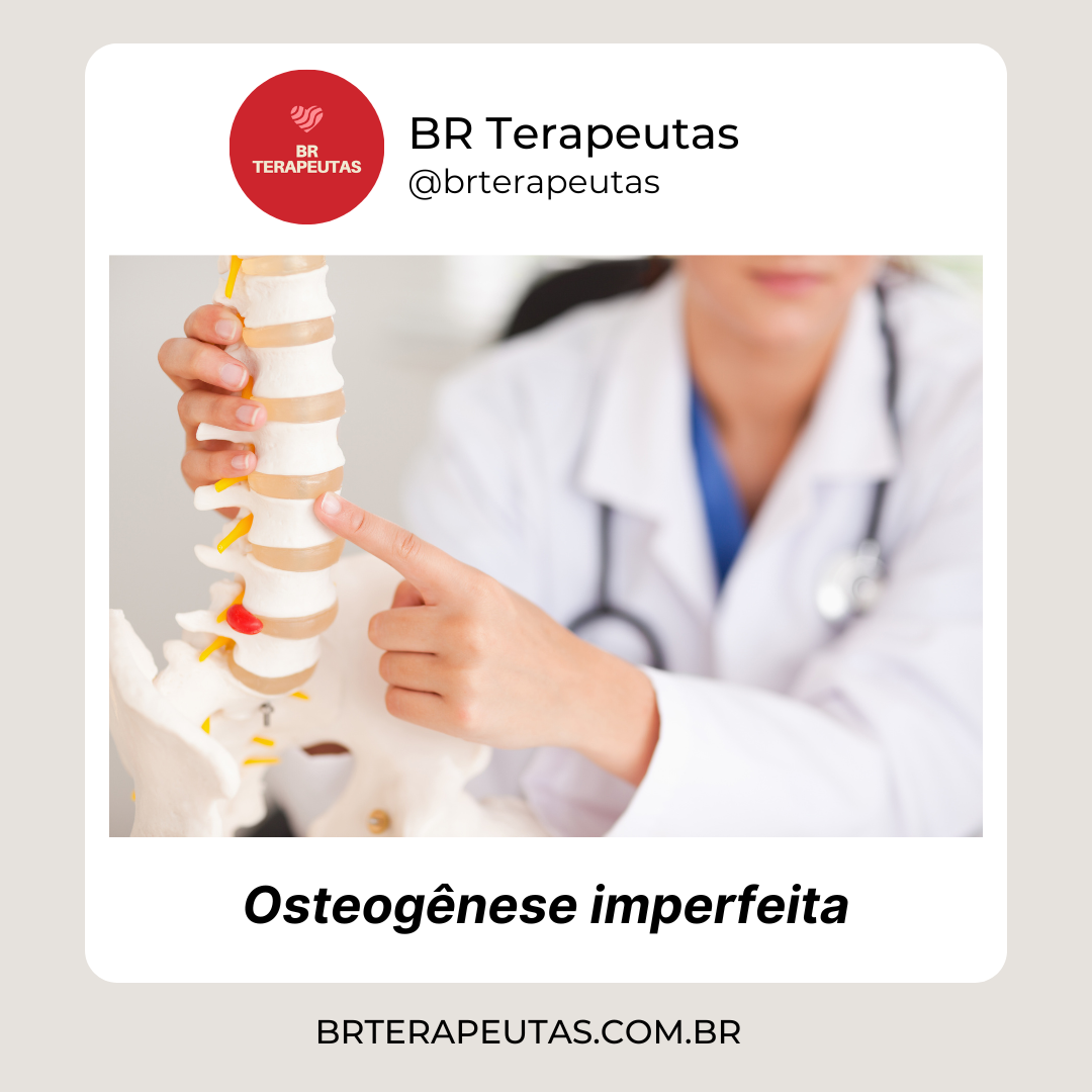 osteogênese imperfeita - foto de uma médica mostrando um osso frágil - BR Terapeutas