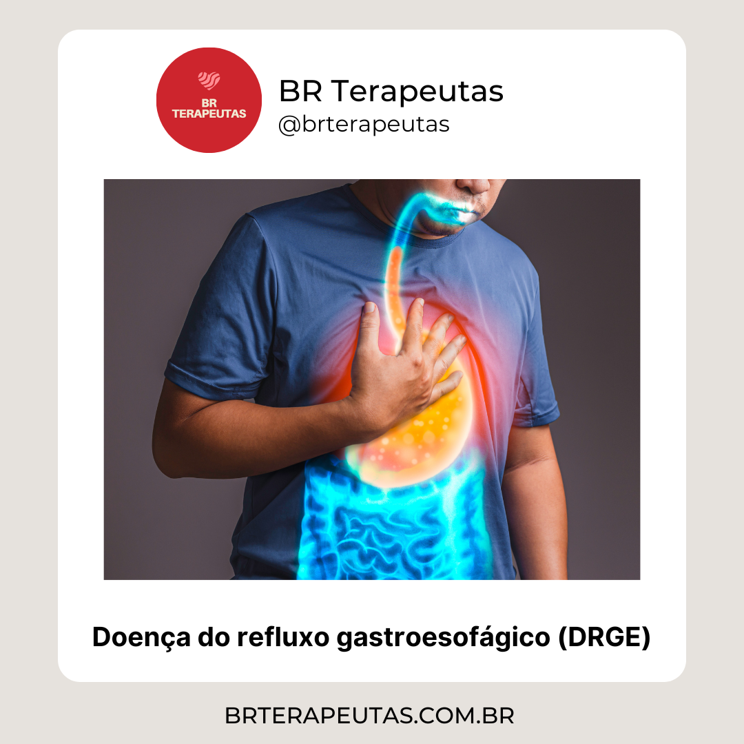 O que é a doença do refluxo gastroesofágico (DRGE)